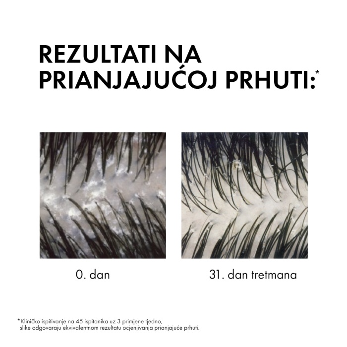 Vichy Dercos AD Šampon protiv peruti za normalnu ili masnu kosu Eco Refill 500 ml