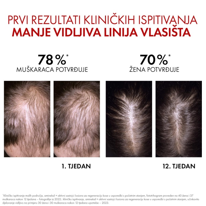 Vichy Dercos Aminexil Clinical Regen Booster serum za obnovu kose 90 ml