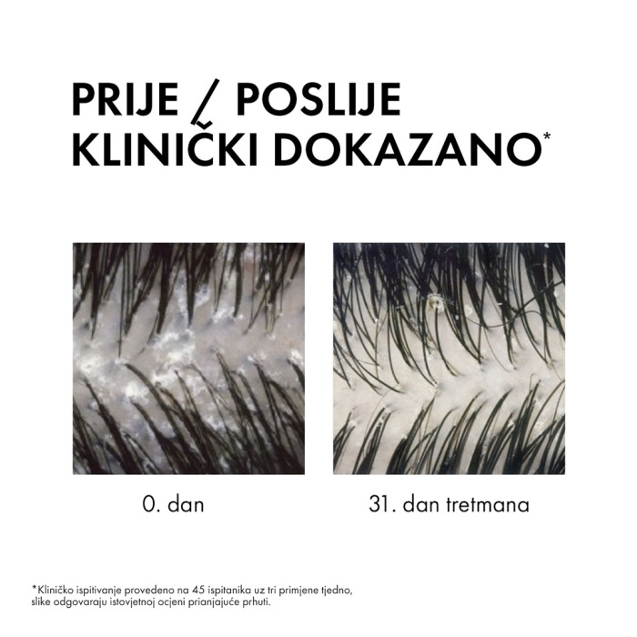 VICHY Dercos Šampon protiv peruti DS 2u1: Dermokozmetički šampon i regenerator 390 ml